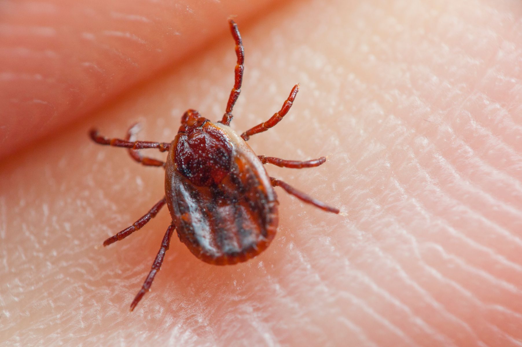 Tick Lyme Disease